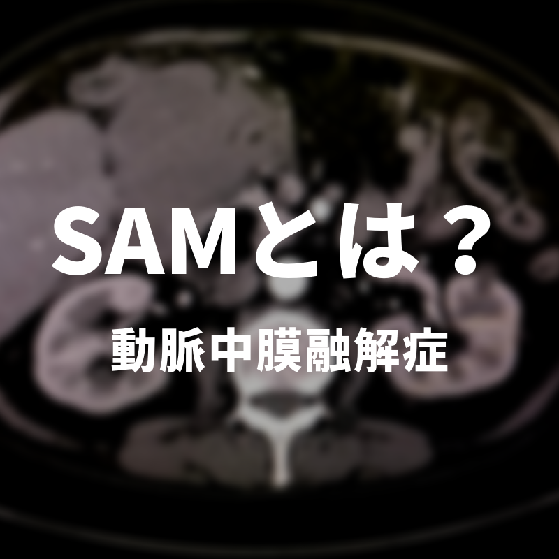 SAM(Segmental Arterial Mediolysis)とは？