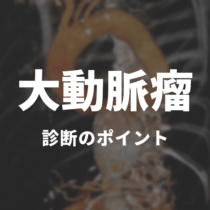 大動脈瘤　診断のポイント
